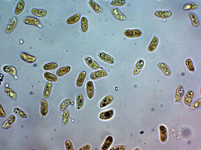 Una corticale granulare da identificare